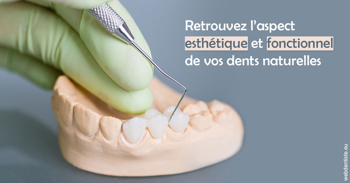 https://www.drbenoitphilippe.fr/Restaurations dentaires 1
