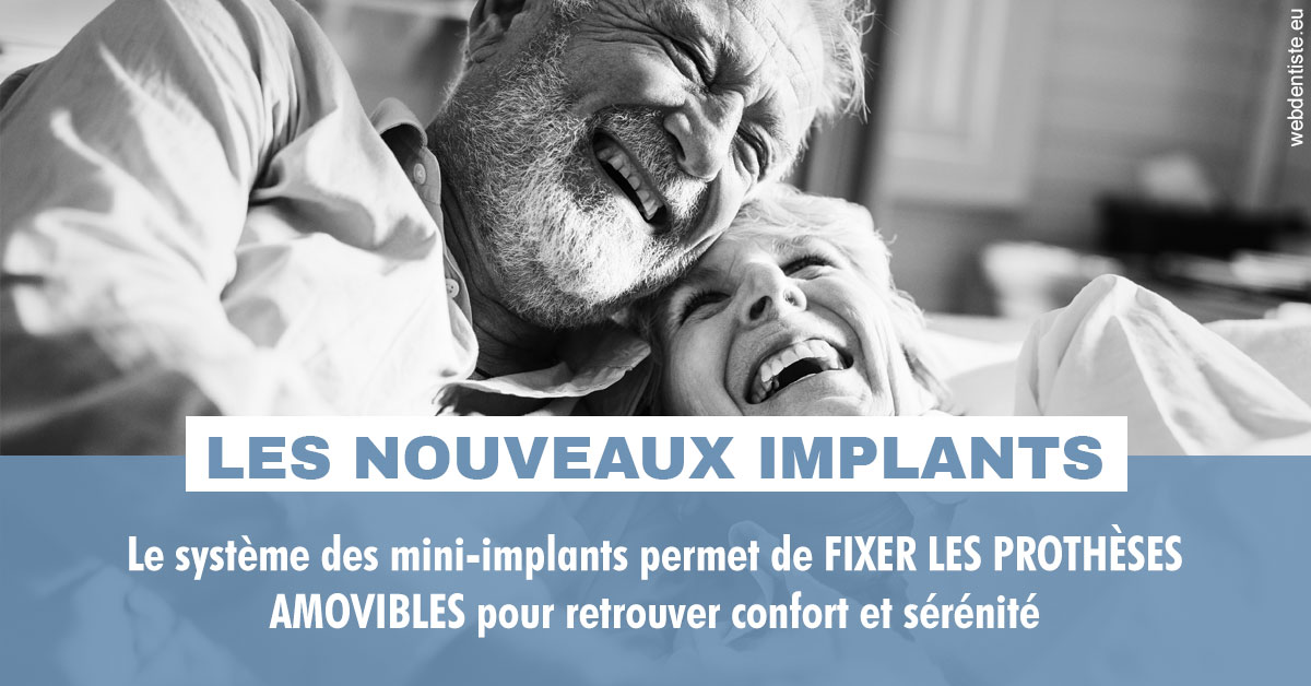 https://www.drbenoitphilippe.fr/Les nouveaux implants 2