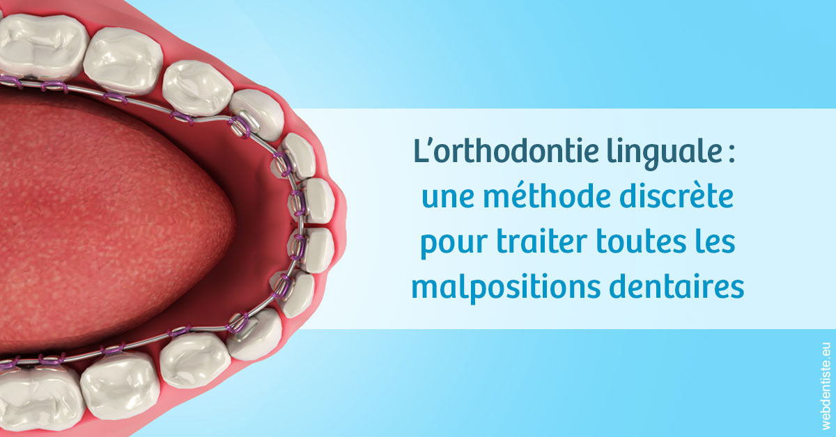 https://www.drbenoitphilippe.fr/L'orthodontie linguale 1