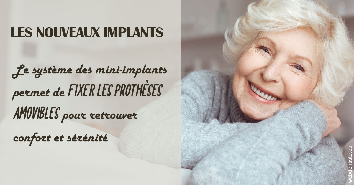 https://www.drbenoitphilippe.fr/Les nouveaux implants 1