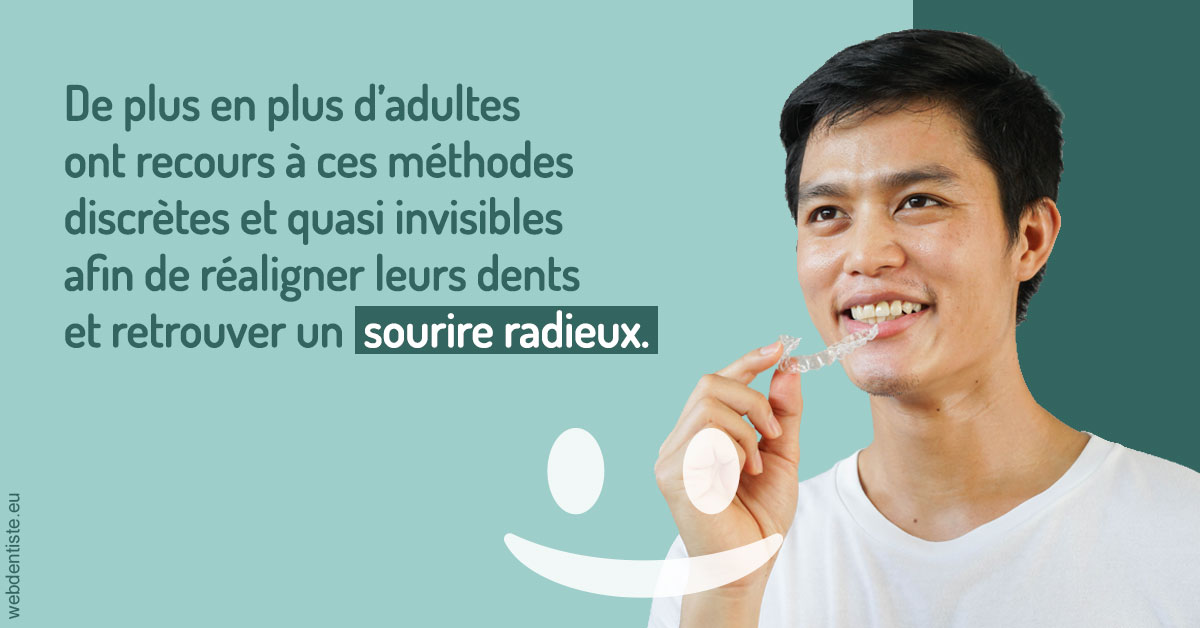 https://www.drbenoitphilippe.fr/Gouttières sourire radieux 2