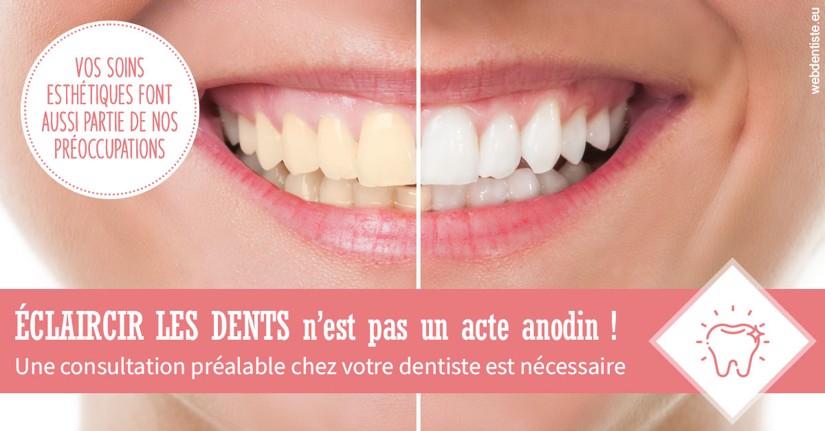https://www.drbenoitphilippe.fr/Eclaircir les dents 1