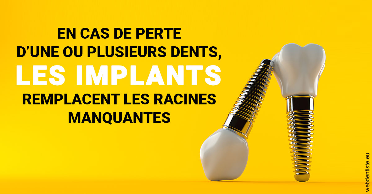 https://www.drbenoitphilippe.fr/Les implants 2
