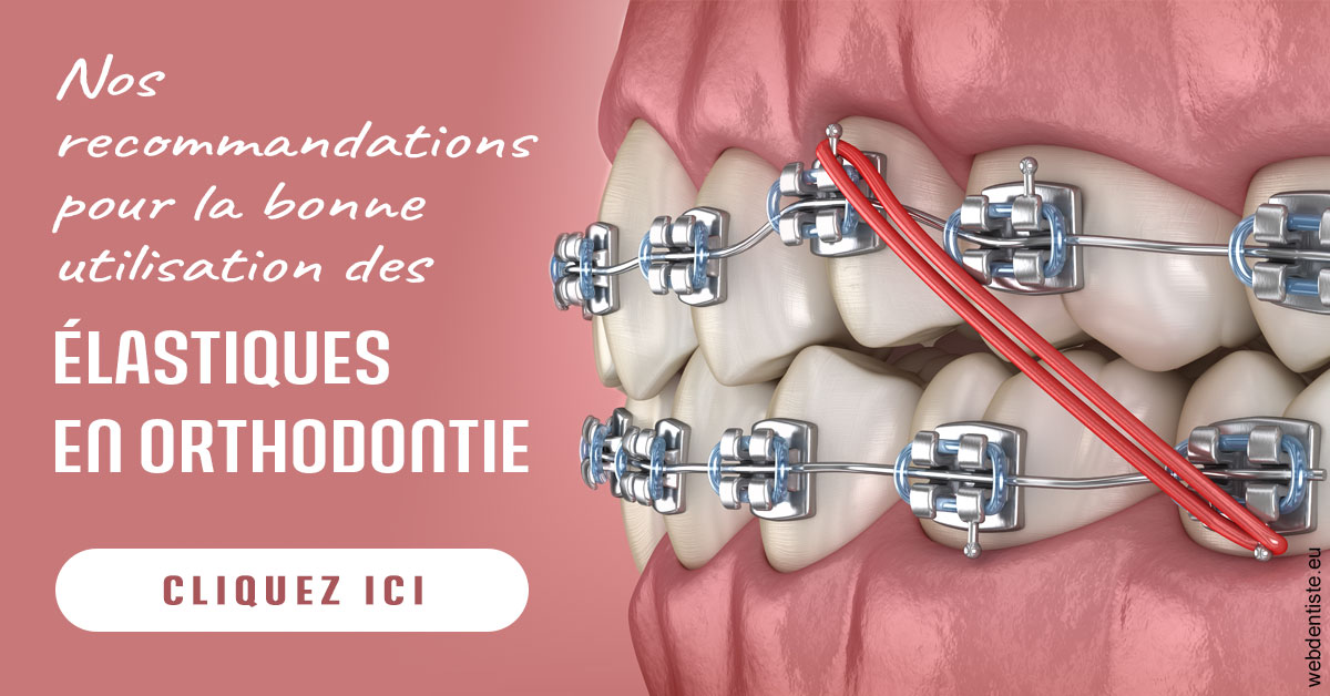 https://www.drbenoitphilippe.fr/Elastiques orthodontie 2